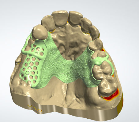 購入 デジタル金属フレーム CAD CAM 歯科設計 3Dプリンタ付きコックル素材 オンライン製造