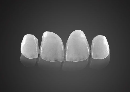 IPS 0.2mm 超薄 エマックス フライヤー 高強度で汚れ耐性