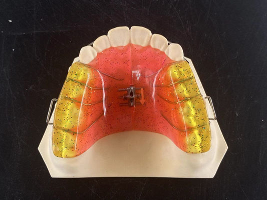 カスタマイズ 2 Ways Dental Arch Expander 調整可能な正歯器具